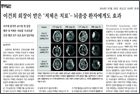 이건희 회장이 받은 '저체온 치료'… 뇌졸중 환자에게도 효과 - 신경과 홍지만 교수