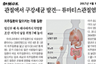 관절액서 구강세균 발견… 류마티스관절염 1.17배 증가 - 치주과 지숙 교수