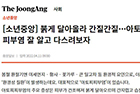 붉게 달아올라 간질간질… 아토피 피부염 잘 알고 다스려보자-소아청소년과 이수영 교수