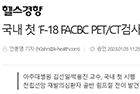 국내 첫 ‘F-18 FACBC PET/CT검사’로 전립선암 재발 조기진단 - 김선일·박용진 교수