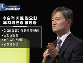 '엄지발가락이 튀어나오고 꺾이는 '무지외반증'