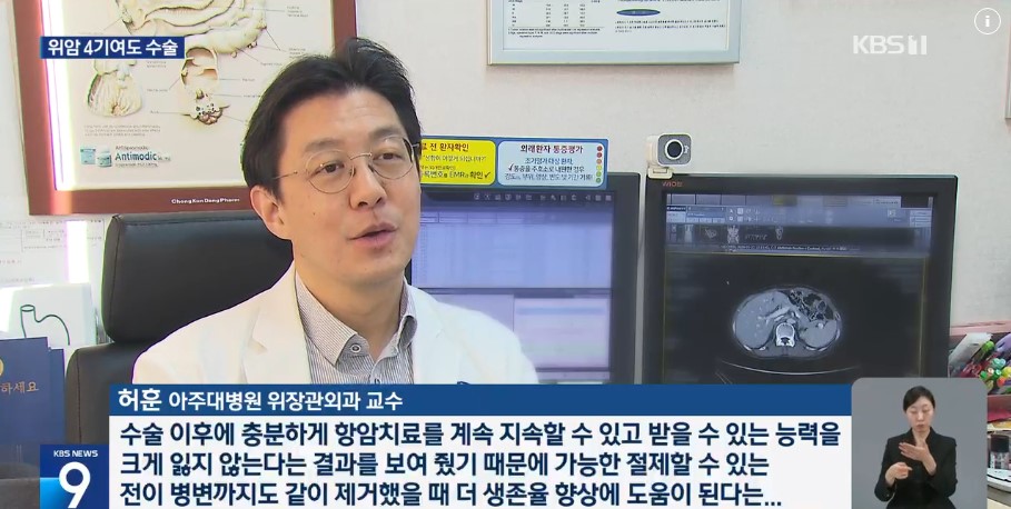 위암 4기, 포기는 금물”…수술로 생존율 10%↑