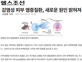 감염성 피부 염증질환, 새로운 원인 밝혀져