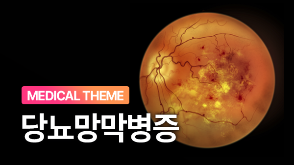 망막에 비치는 혈관의 경고