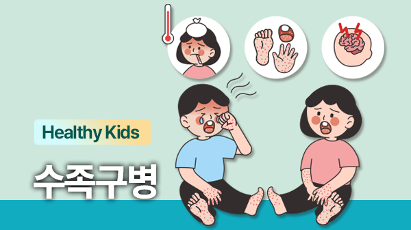 아이 입이나 손발에 물집이? 수족구병