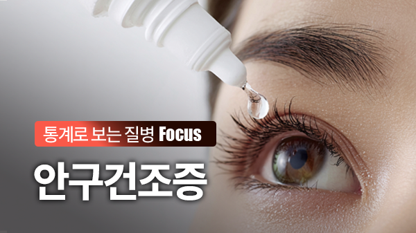 눈물 부족만으로 설명할 수 없는 안구건조증