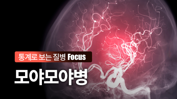 조기 진단과 치료로 극복 가능한 희귀질환, 뇌혈관질환 모야모야병