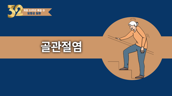 사람마다 다른 무릎, 치료도 달라야 한다 - 골관절염